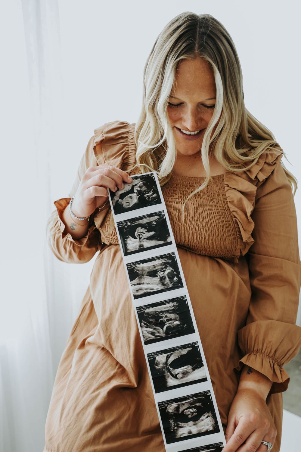 Person holding strip of ultrasound photos while wearing brown dress.