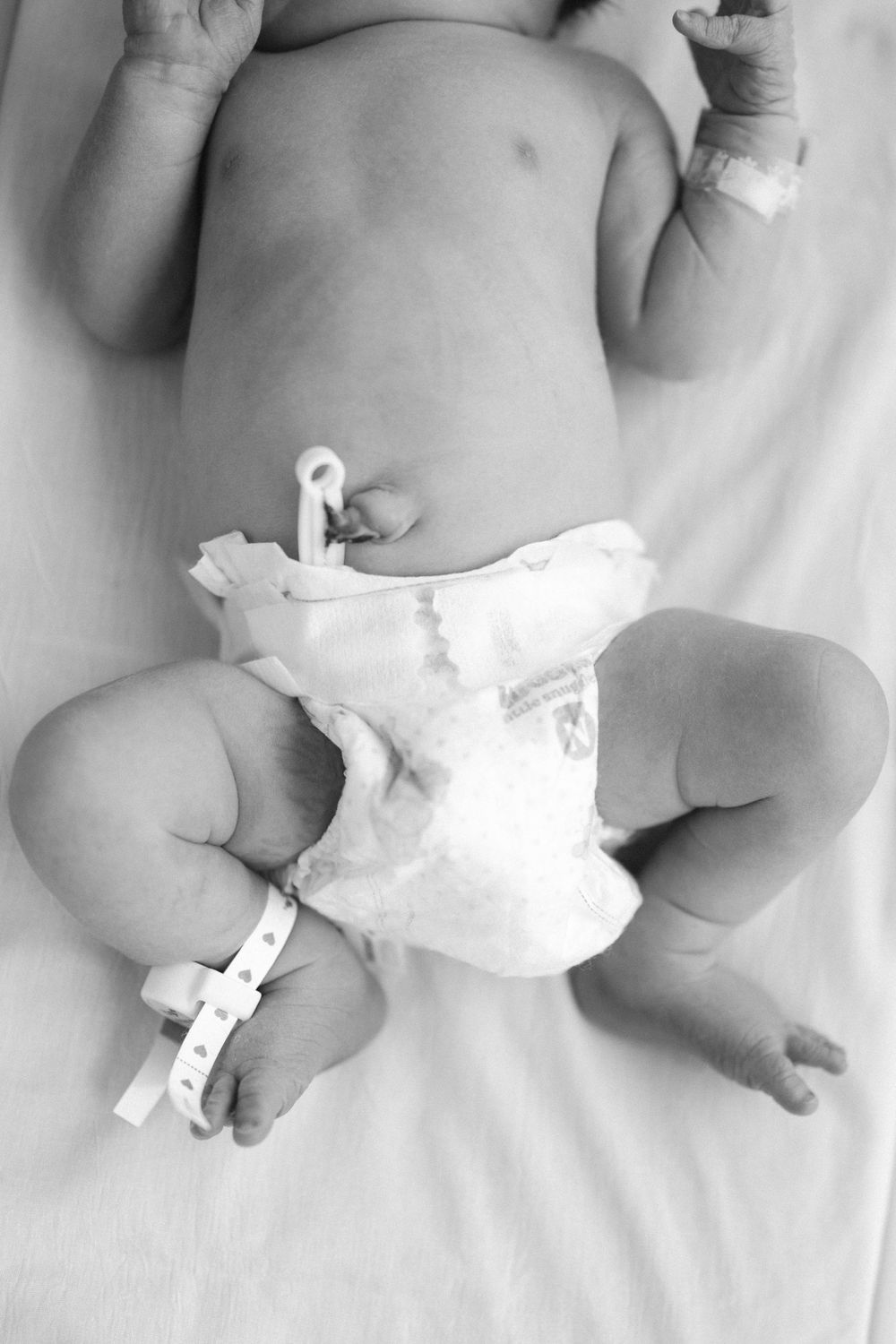 Black and white photo of a newborn baby in a diaper with a hospital ID bracelet on their ankle.