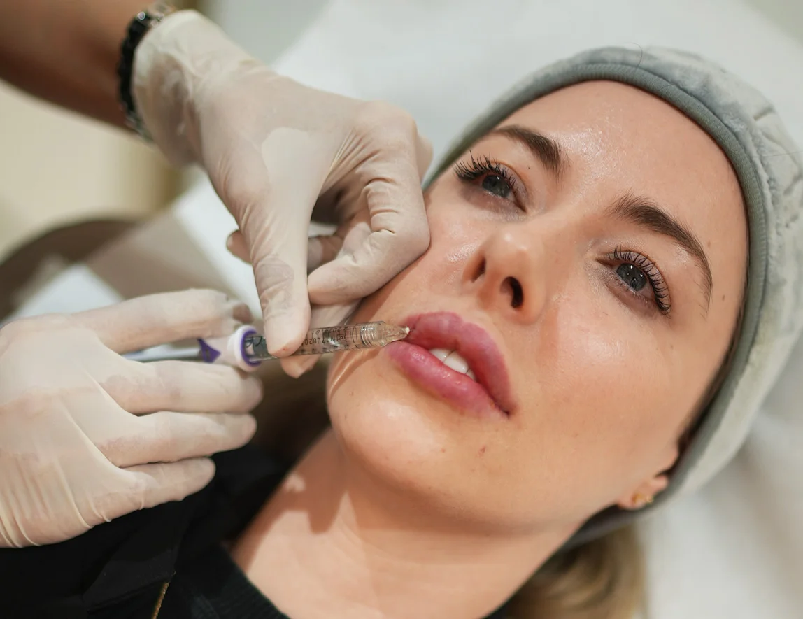 Best Lip Fillers Injections