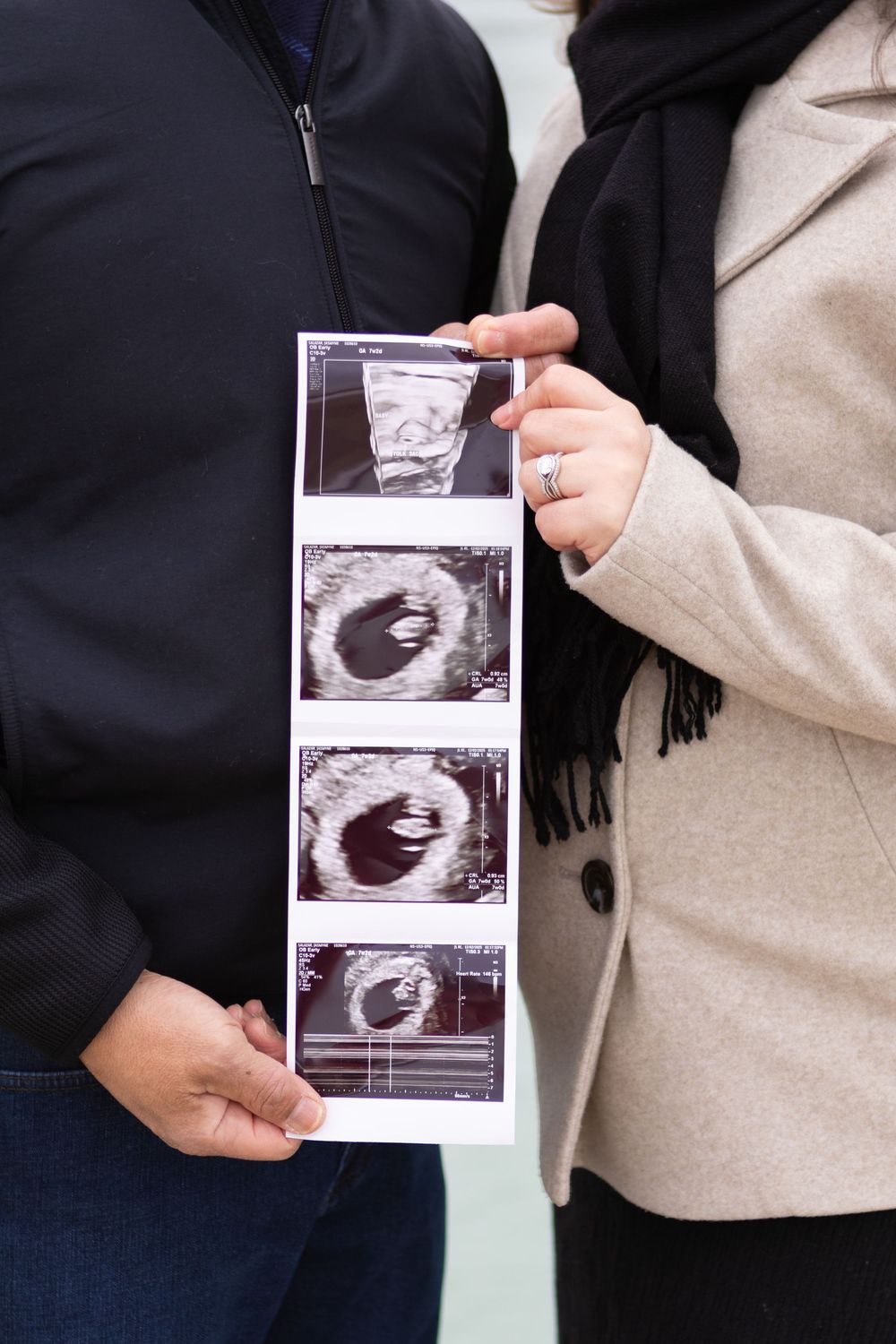 Hands holding ultrasound scan photos showing prenatal images against a dark and light clothing background.