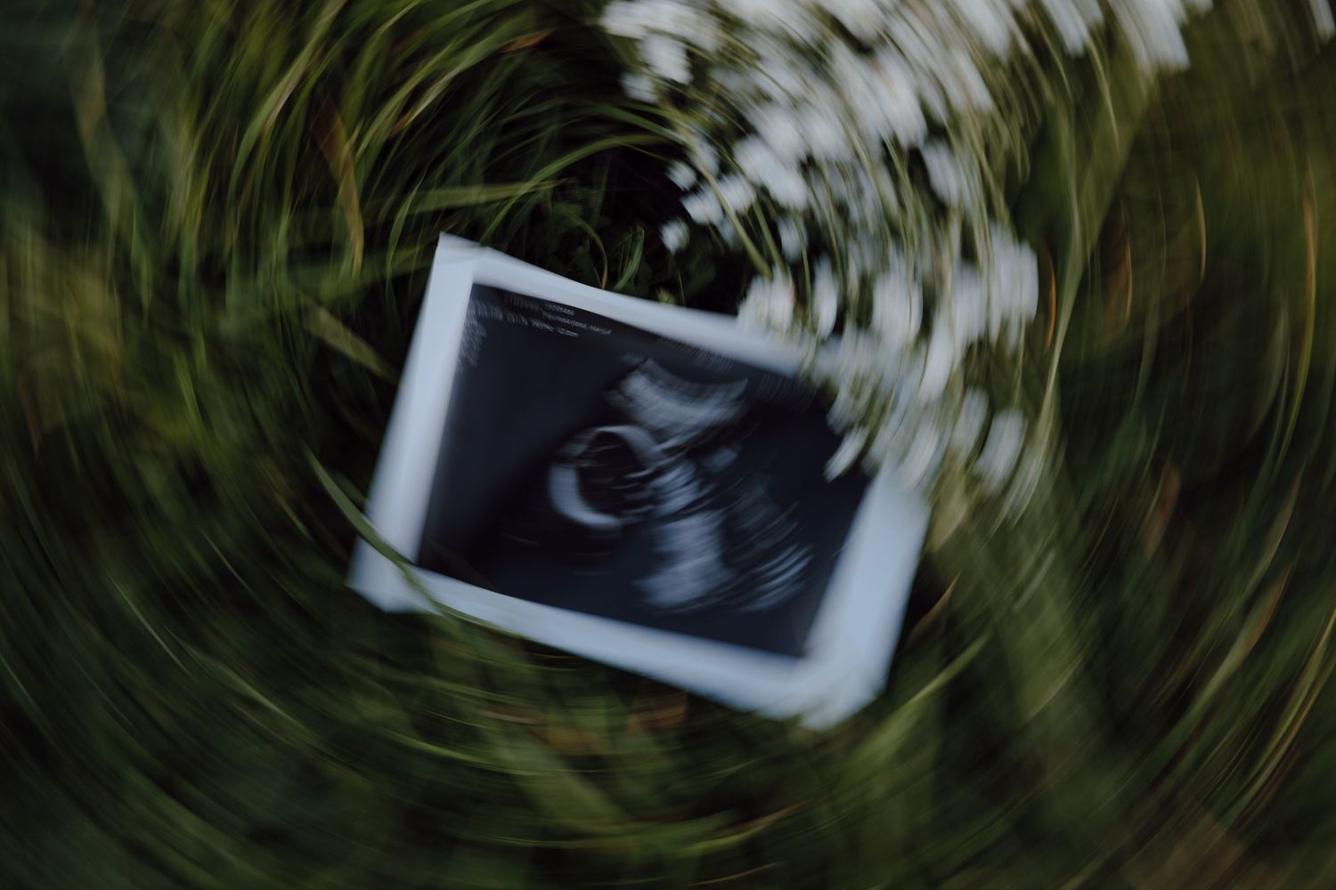 Ultrasound photo with swirling motion blur effect against dark background.