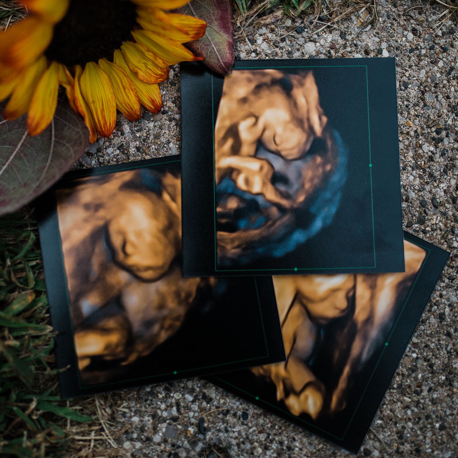 Ultrasound photos displayed with a sunflower against a concrete background.