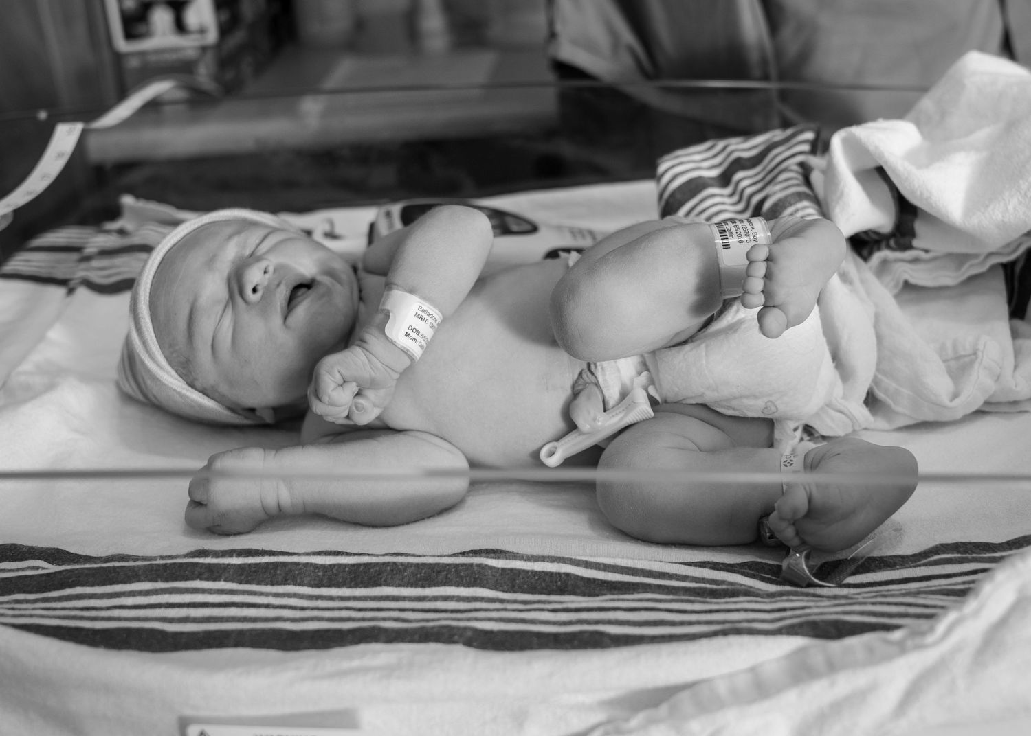 Black and white photo of a newborn baby lying on a striped blanket with a hospital ID bracelet.