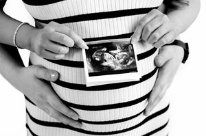 Pregnant woman in striped dress holding ultrasound photo with partner's hands on baby bump, black and white photo.
