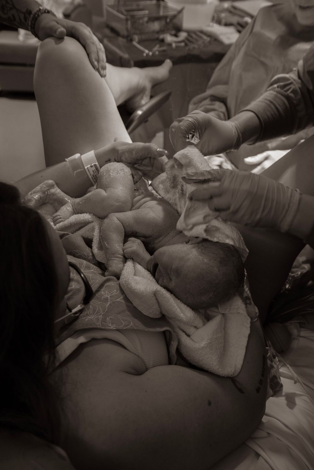 Black and white photo of a newborn baby being held by medical staff moments after birth in a hospital delivery room.