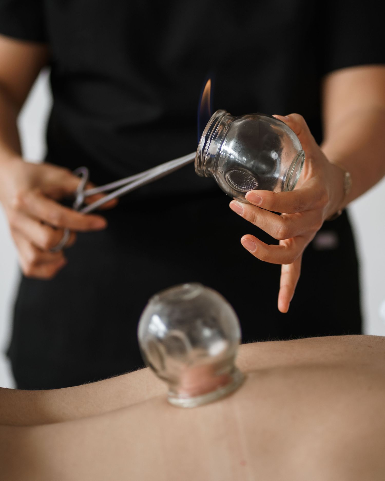 Close-up shot of hands performing cupping therapy treatment with glass jars on bare skin.