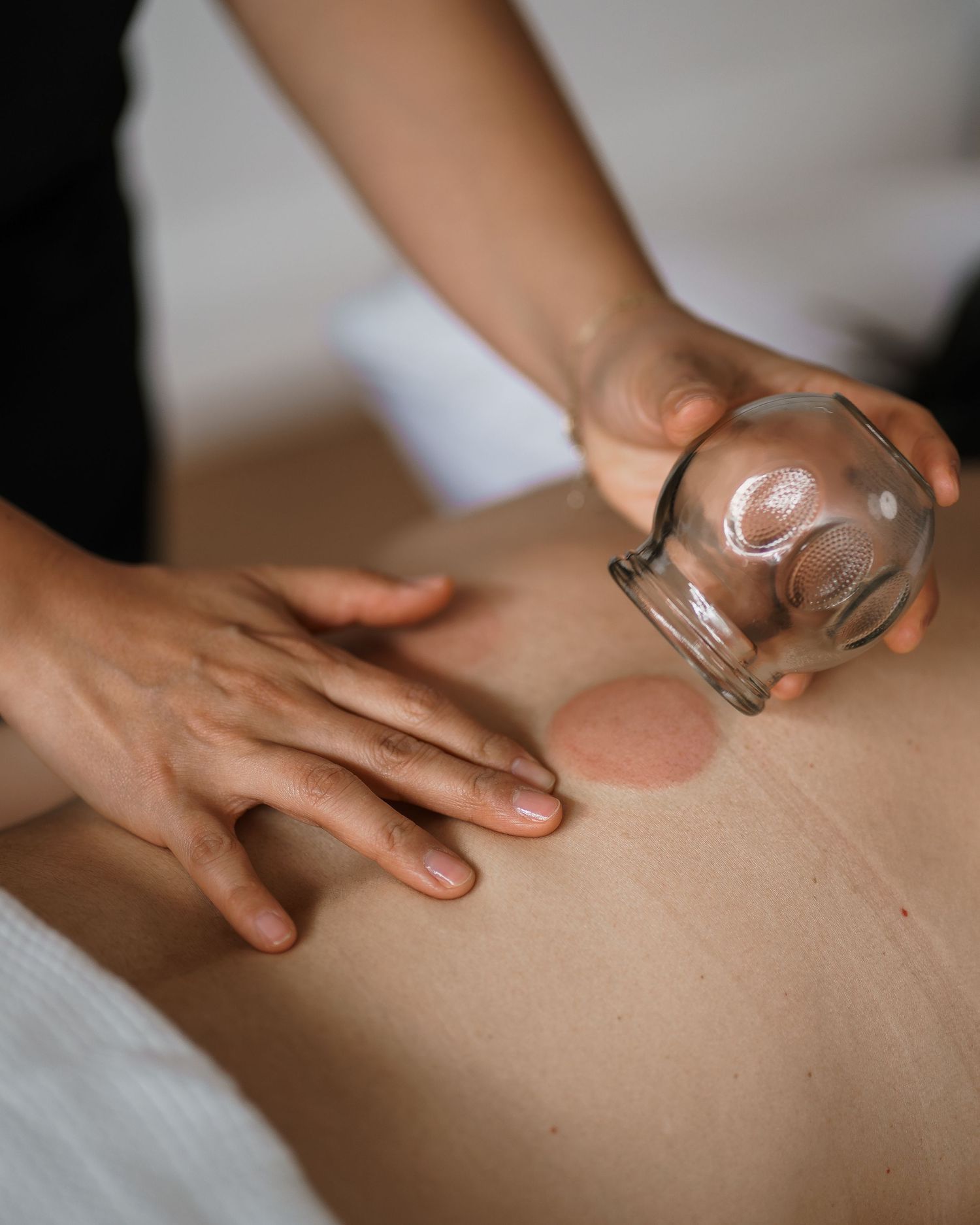 A sequence of images showing cupping therapy treatment being performed on bare skin with glass cups.