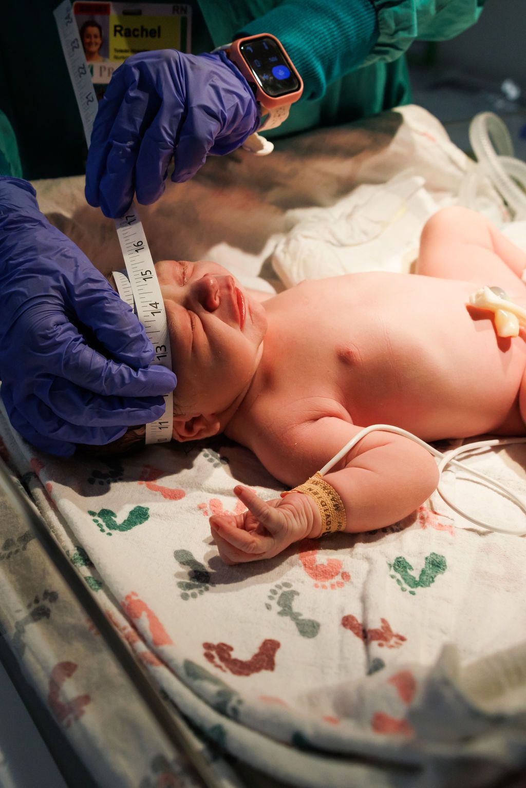 Medical staff measuring a newborn baby's head circumference with a tape measure in a hospital delivery room.