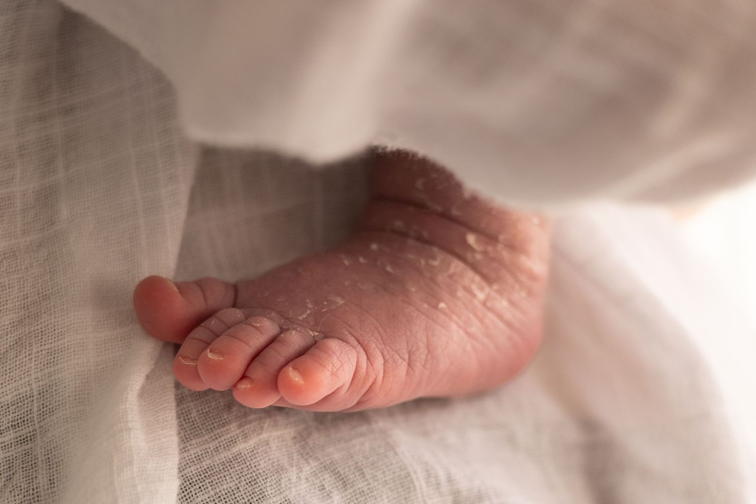Newborn flakey feet resting on mum