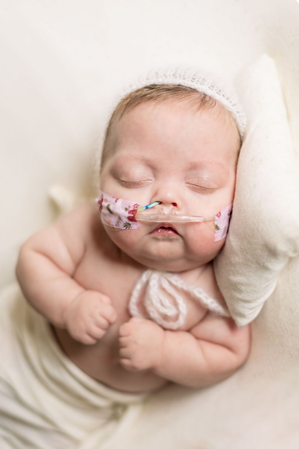 nicu premature baby