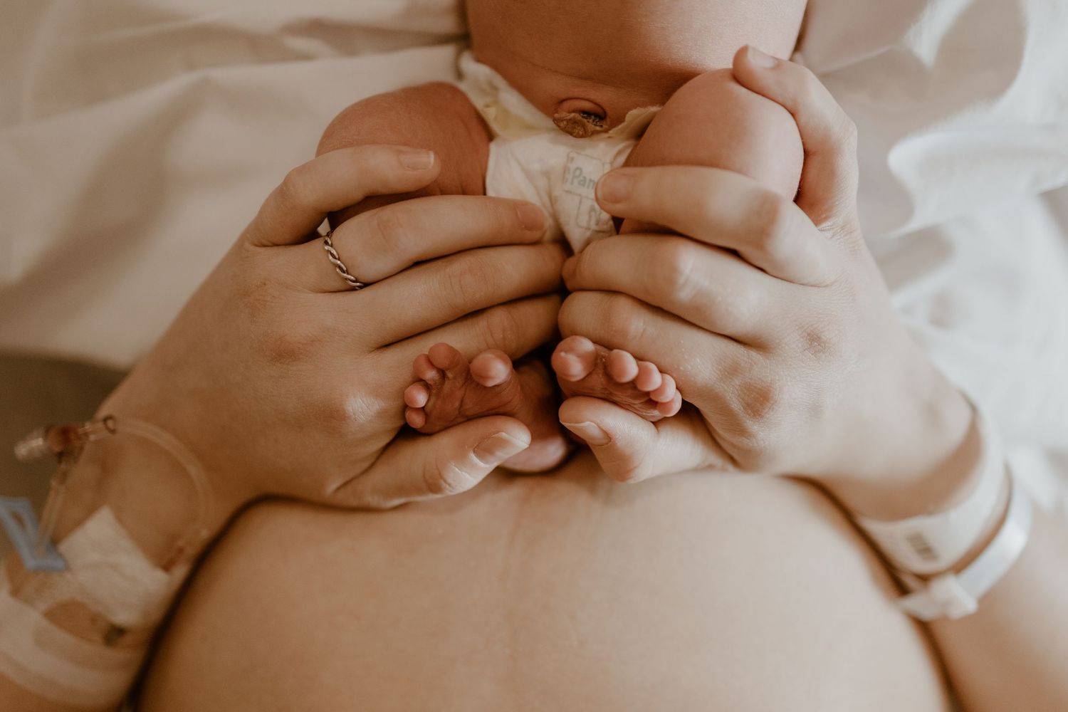 A newborn baby lies in a newborn hospital bassinet wearing a diaper while yawning.
