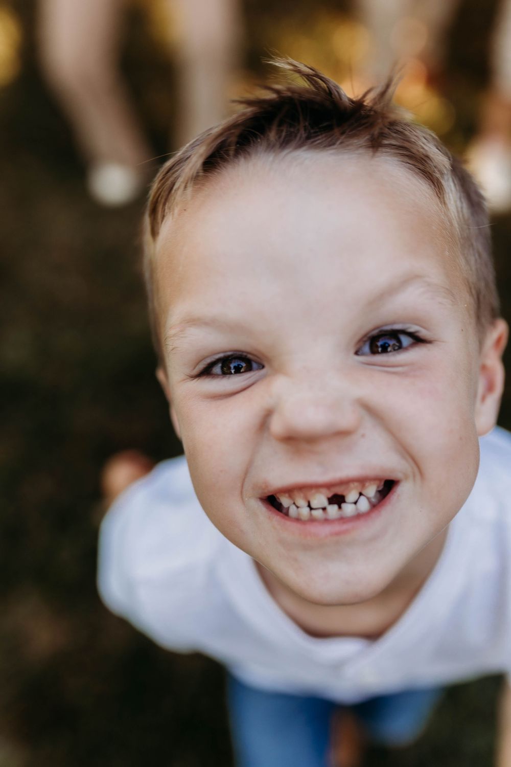 Adorable young boy with missing teeth giving a big goofy smile directly at camera.