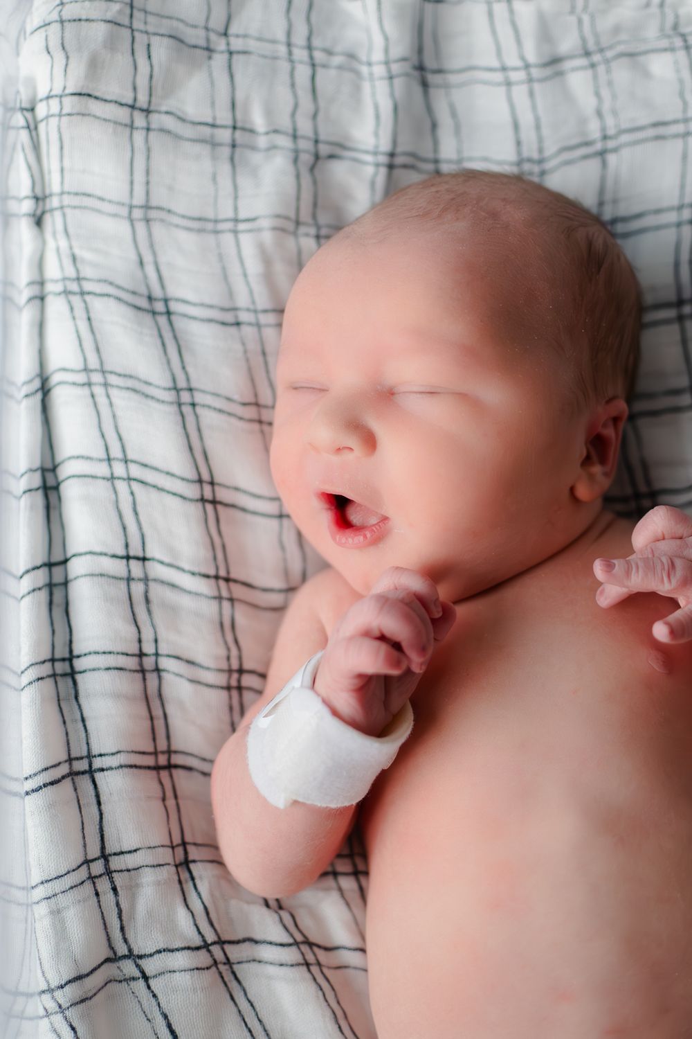 A sleeping newborn baby lies on a plaid blanket with a medical bandage on their tiny wrist.