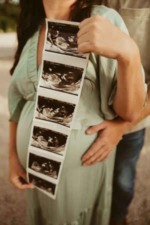 Pregnant woman in mint dress holds ultrasound strip while partner embraces her baby bump outdoors.
