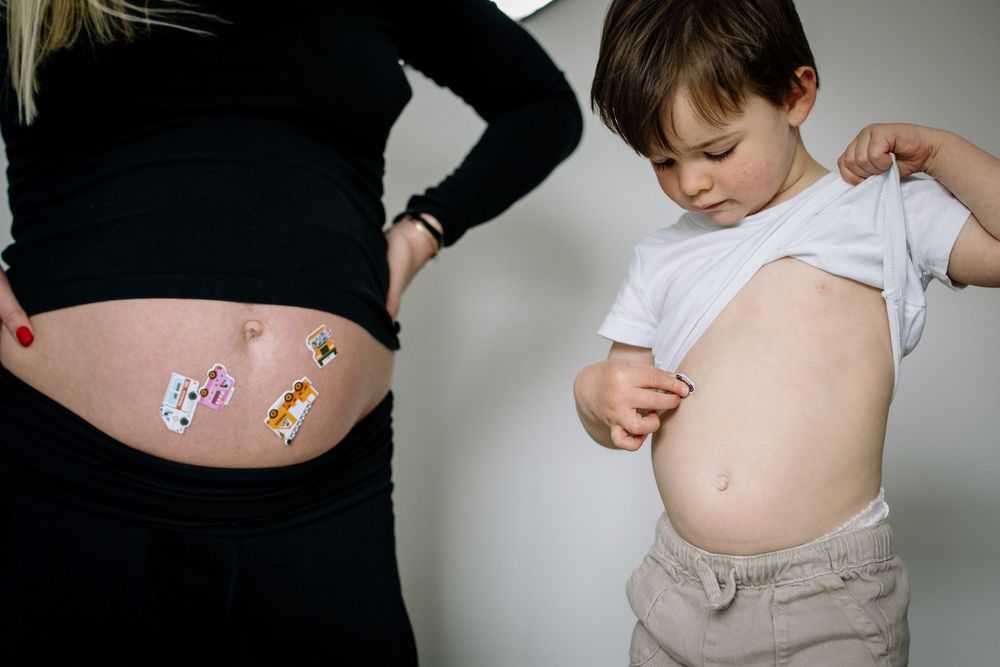 Two people comparing bandages on their bare bellies with colorful cartoon bandages displayed against skin.