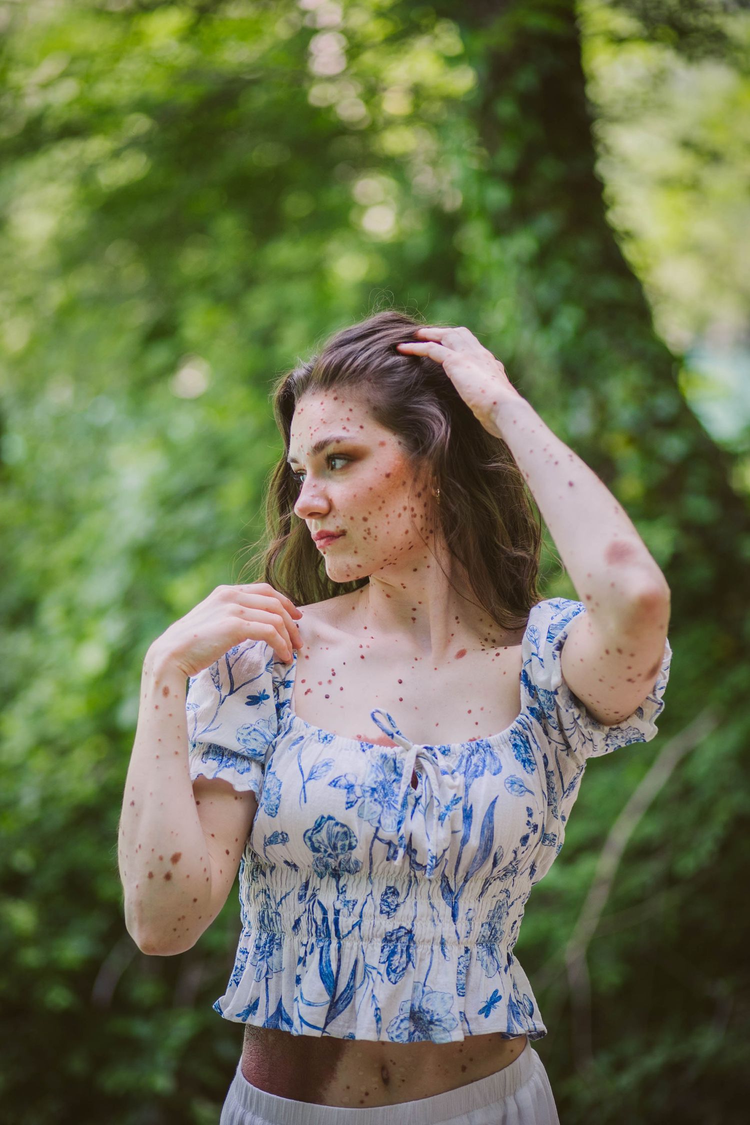 A woman in a blue and white floral dress poses against a blurred green nature background.