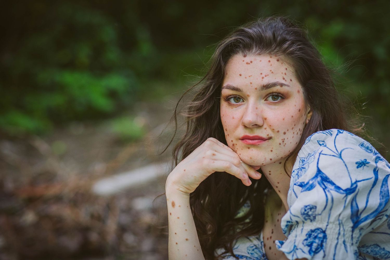 A portrait of a young woman in a blue floral dress rests her chin on her hand while sitting outdoors.