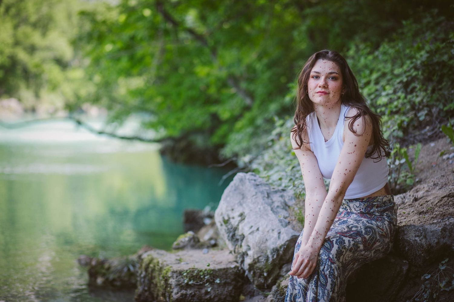 Woman in casual attire sits by a serene lake surrounded by lush greenery on a summer afternoon.