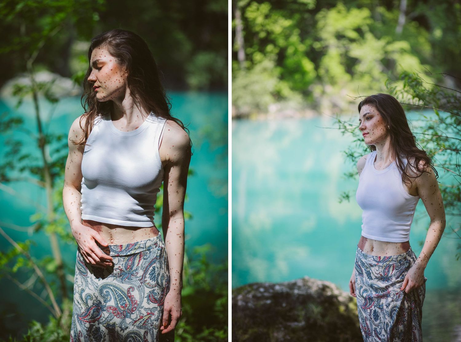 A person wearing floral print pants and a white crop top poses against a lush green nature background.