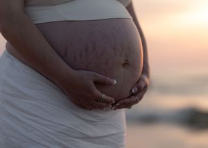 Pregnant woman in white dress cradling her bare baby bump with stretch marks at sunset on a beach.