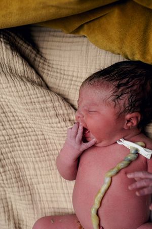 Peaceful newborn baby yawning with umbilical cord clamp, resting on soft blankets after birth.