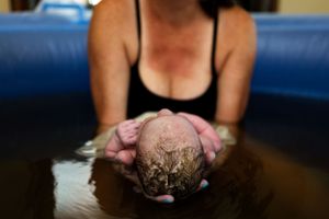 A peaceful water birth takes place in a birthing pool as the newborn emerges.