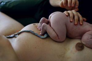 Newborn baby lying on mother's chest with umbilical cord still attached after birth.