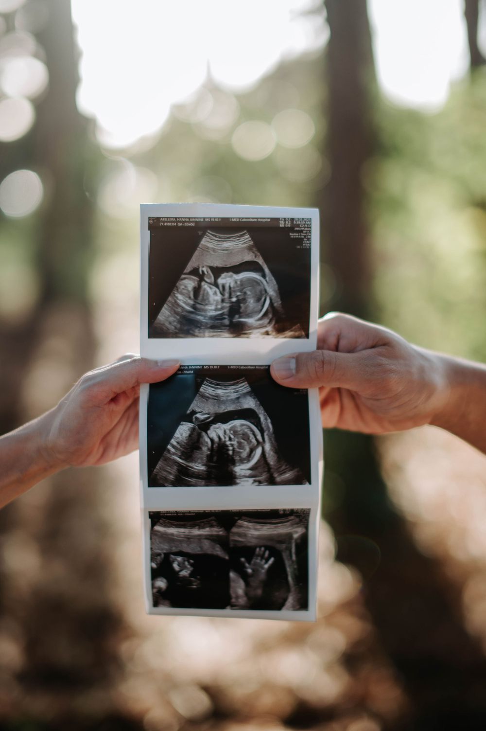 Hands hold three ultrasound photos against blurred forest background.