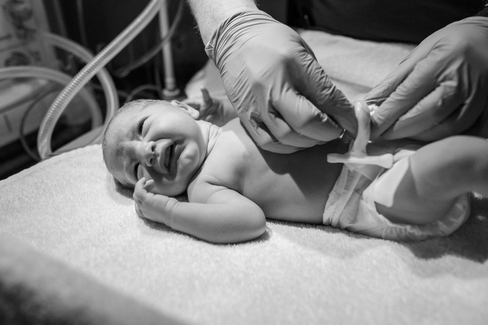 A newborn baby cries during a medical examination on a hospital bed.