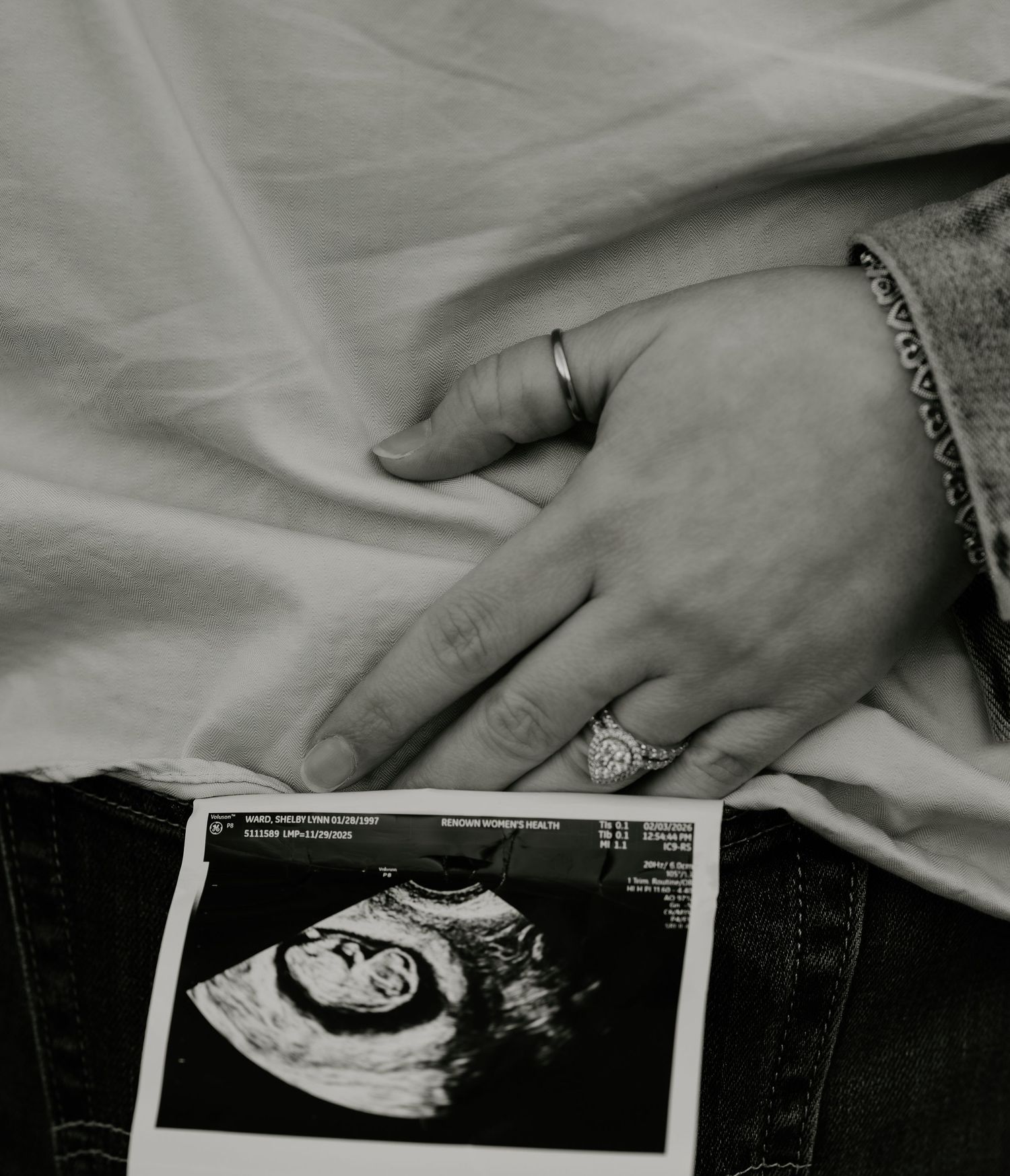 Black and white photo of hands resting on pregnant belly beside an ultrasound scan image.