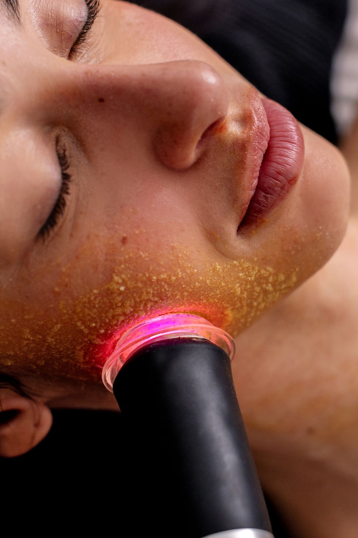 Oxy-geneo Facial. 3-in-1 super facial. Canada's #1 facial. Exfoliates, oxygenates, and infuses the skin to improve complexion. Glow Barrie