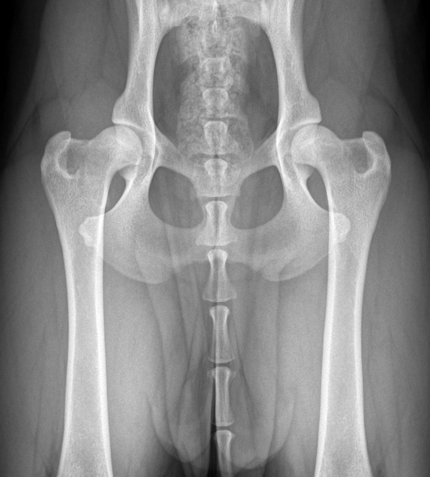 X-ray image showing hip and pelvic bones in black and white.