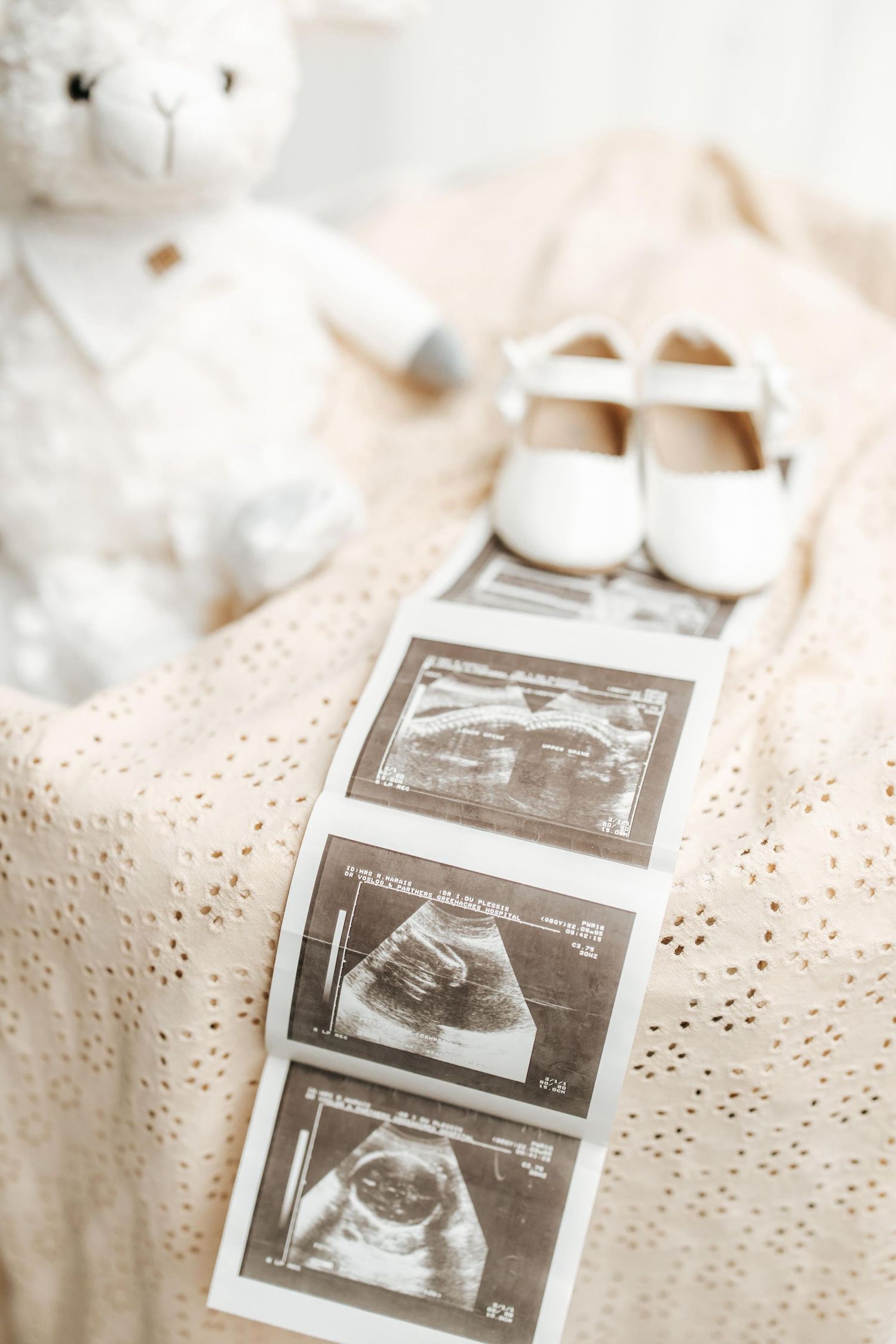 Black and white ultrasound images displayed on a light textured surface with soft focus edges.