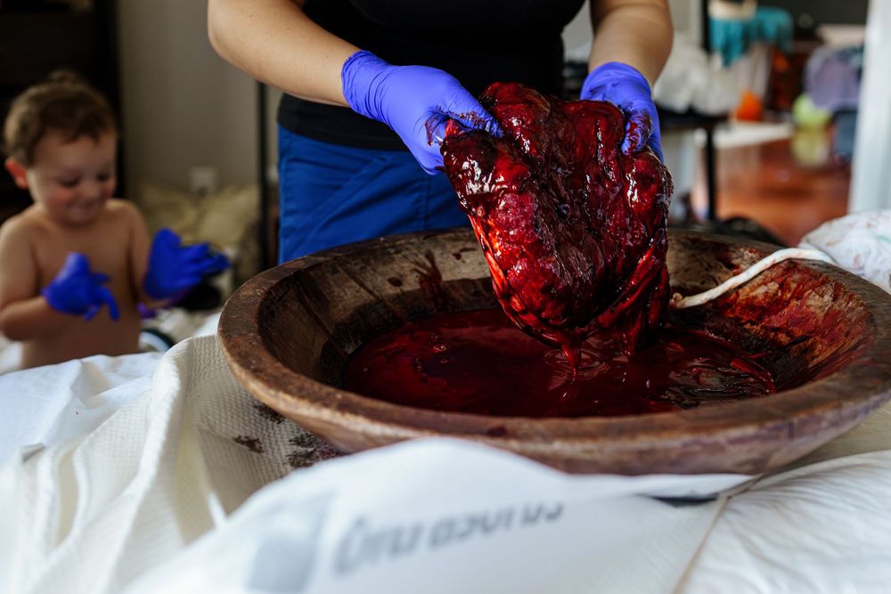 Medical professional in protective gloves handles placental tissue on examination table.