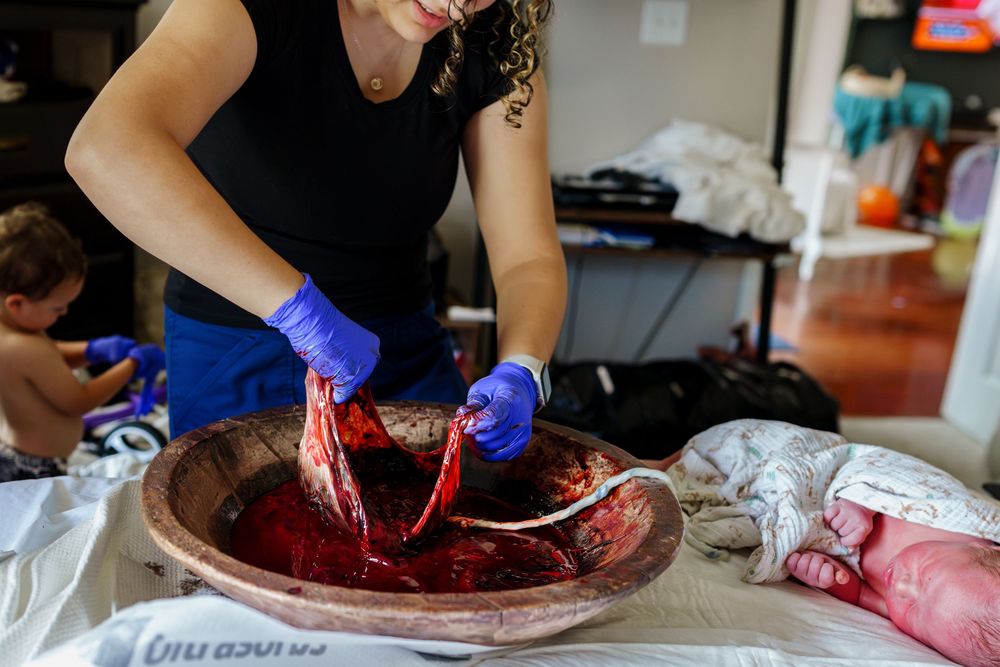 Close-up view of medical examination with blue gloved hands and red tissue.