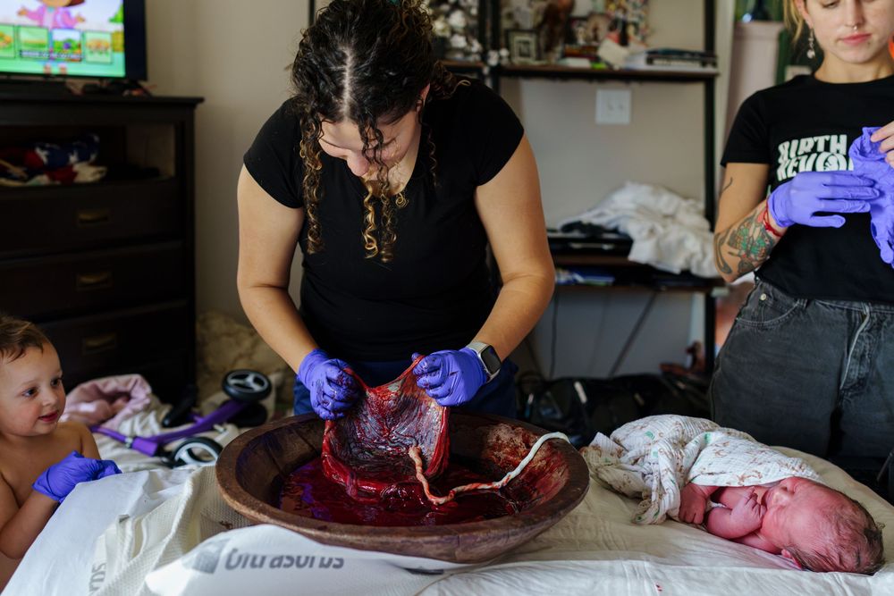 Medical professionals in blue gloves examine a placenta in a wooden bowl during a home birth examination.