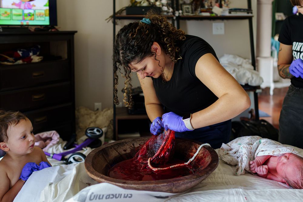 A medical examination of placental tissue takes place on a wooden dish while others observe.