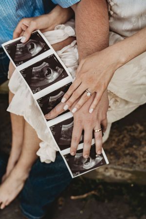 Close-up of couple's hands resting on ultrasound strip photos, woman wearing engagement ring.