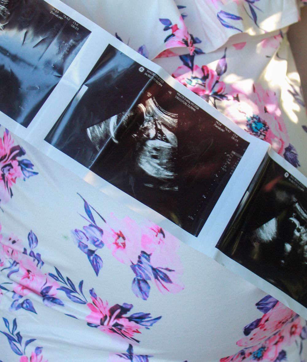 Floral patterned fabric with pink and purple flowers against a white background.