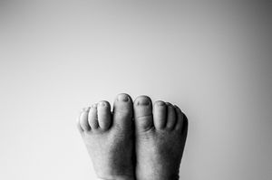 Black and white close-up photograph of bare feet with curved toes against a white background.
