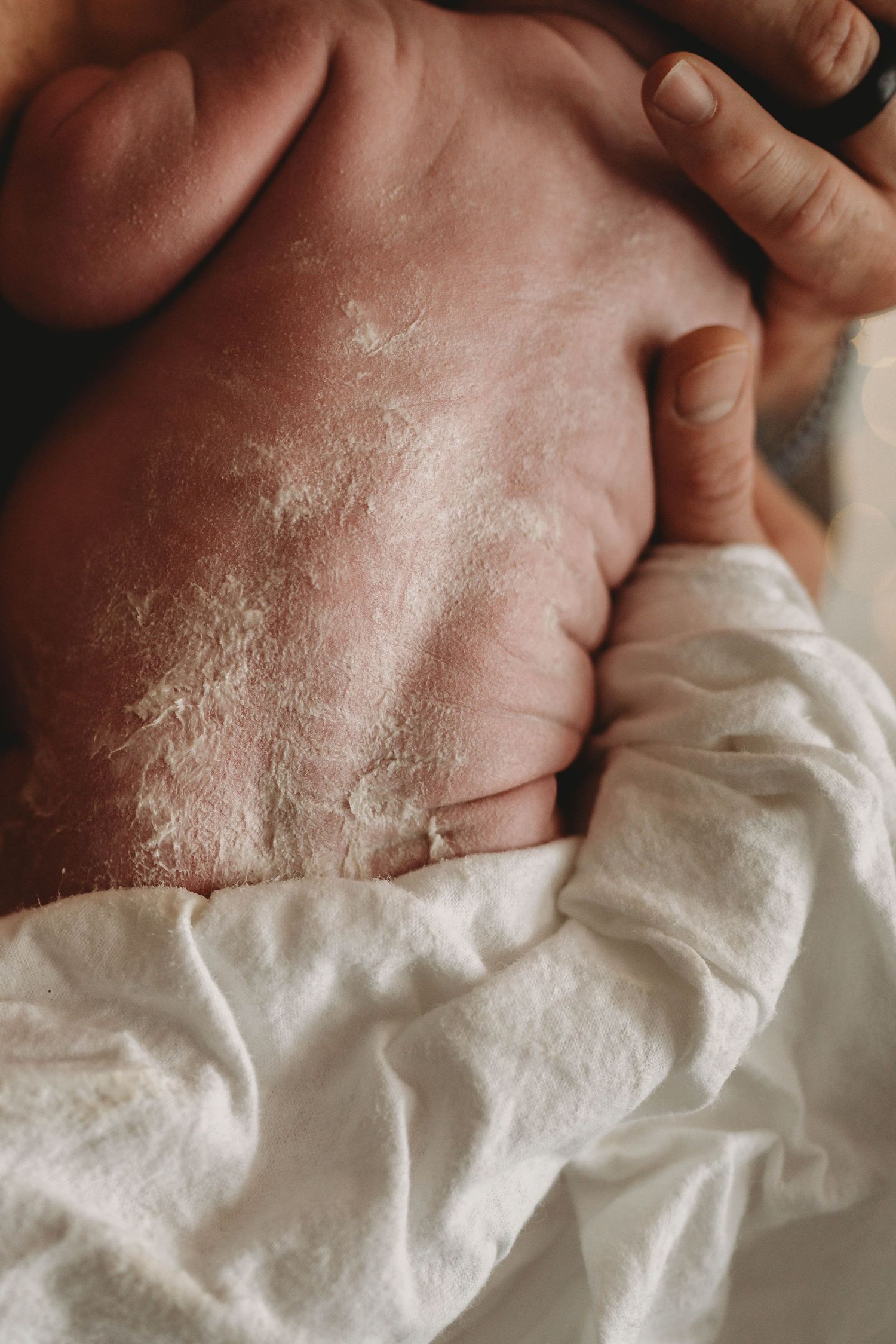 Close-up of baby's skin with white fabric showing natural newborn texture.