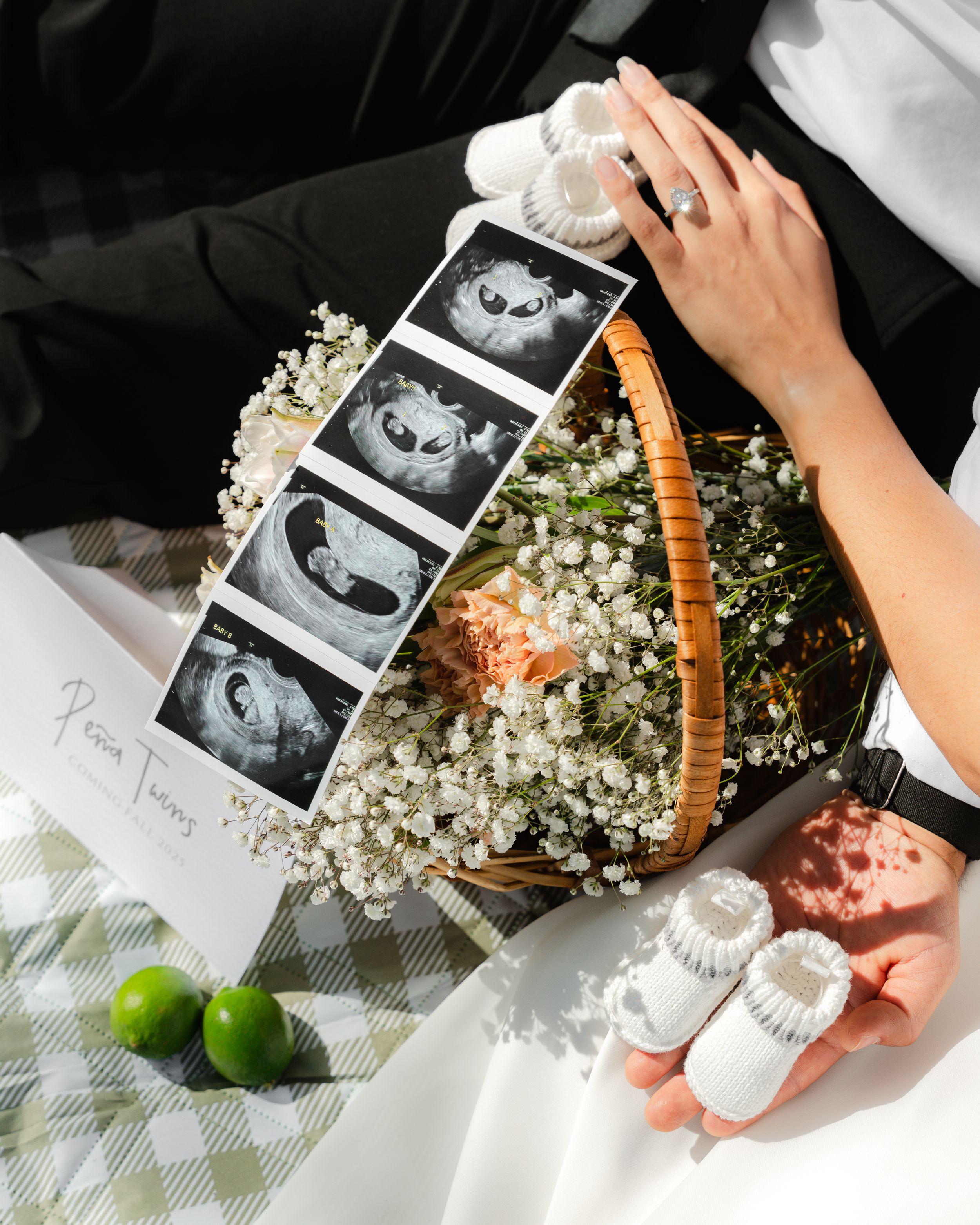 Ultrasound photos displayed with white baby shoes and baby's breath flowers in a basket next to fresh limes on checkered cloth.