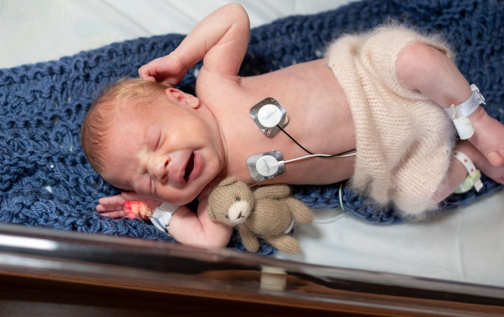 Connor's Friends NICU Photography, NICU, NICU Baby, Preemie, Connor's Friends