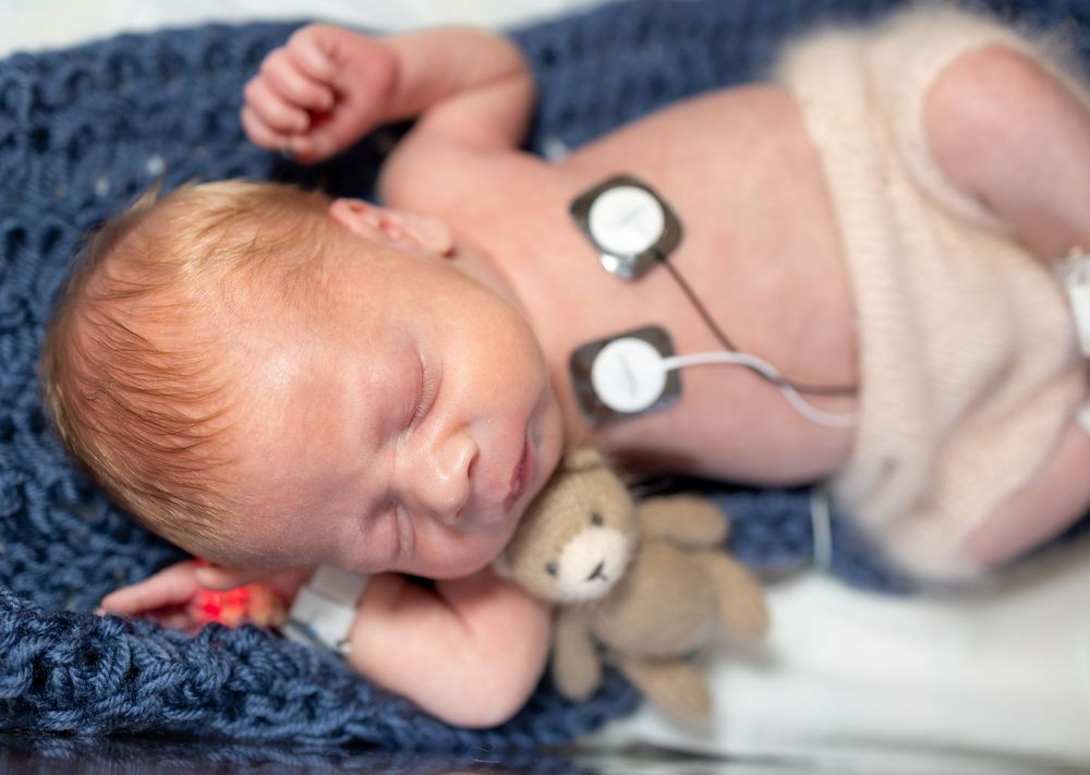 Connor's Friends NICU Photography, NICU, NICU Baby, Preemie, Connor's Friends