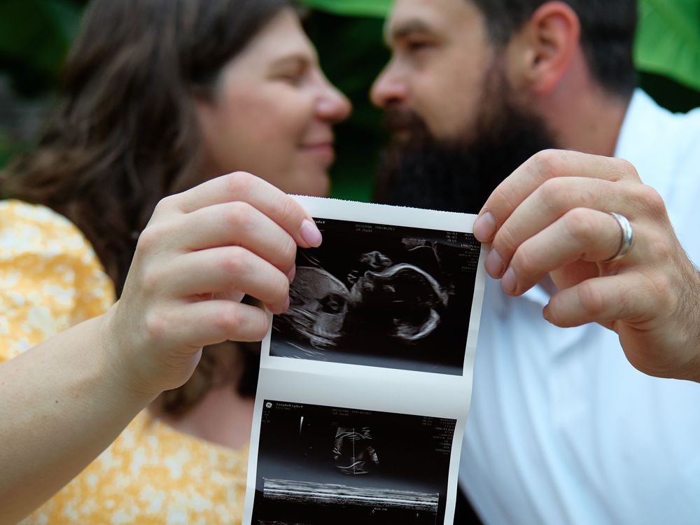 Couple holding ultrasound photos while leaning in for a kiss, announcing their pregnancy outdoors.