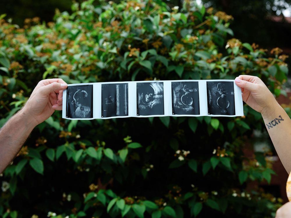 Hands holding a strip of ultrasound images in front of green foliage, showing fetal development stages.