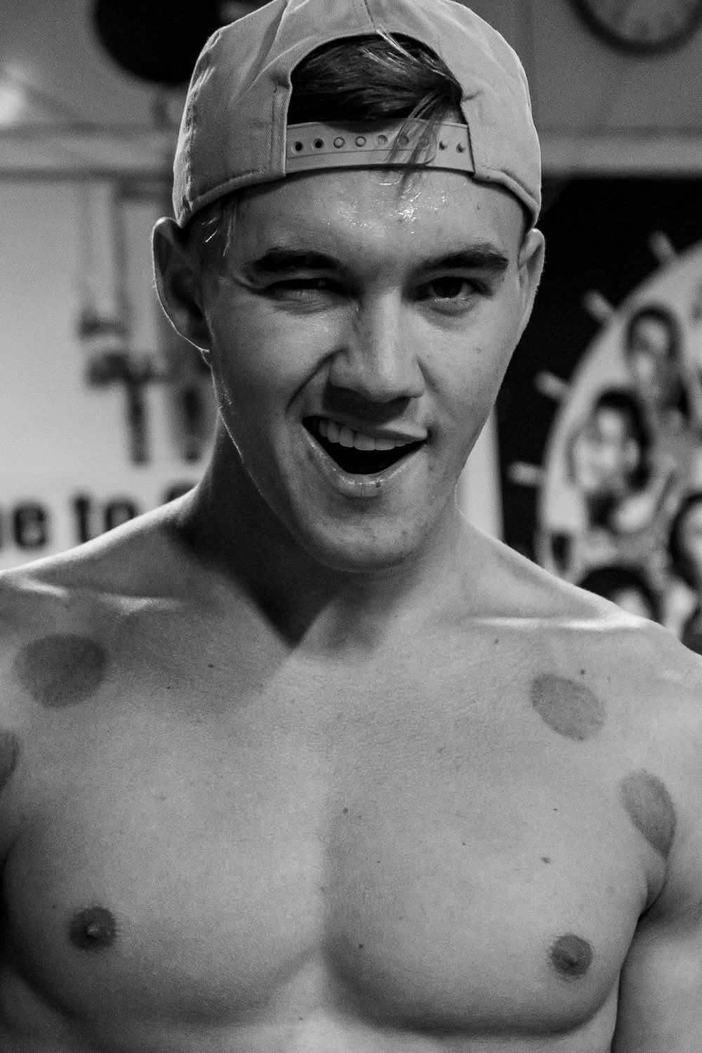 Shirtless young male athlete with cupping therapy marks smiles in a black and white gym photo.