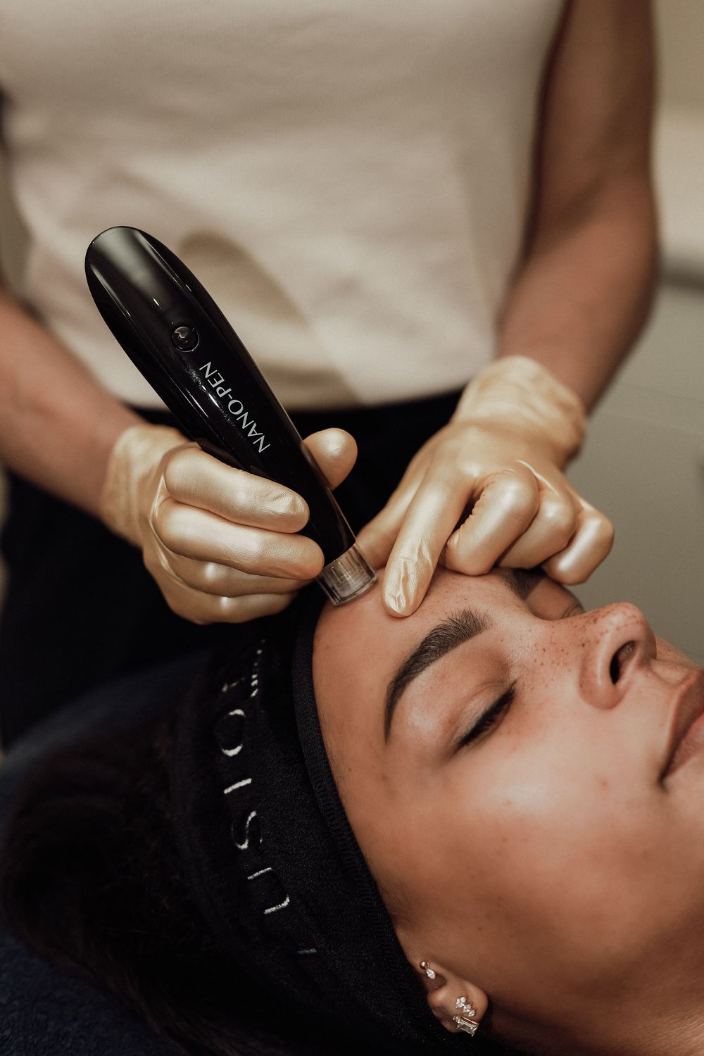 Esthetician in gold gloves using a NanoPen microneedling device on a woman's forehead during a facial treatment.