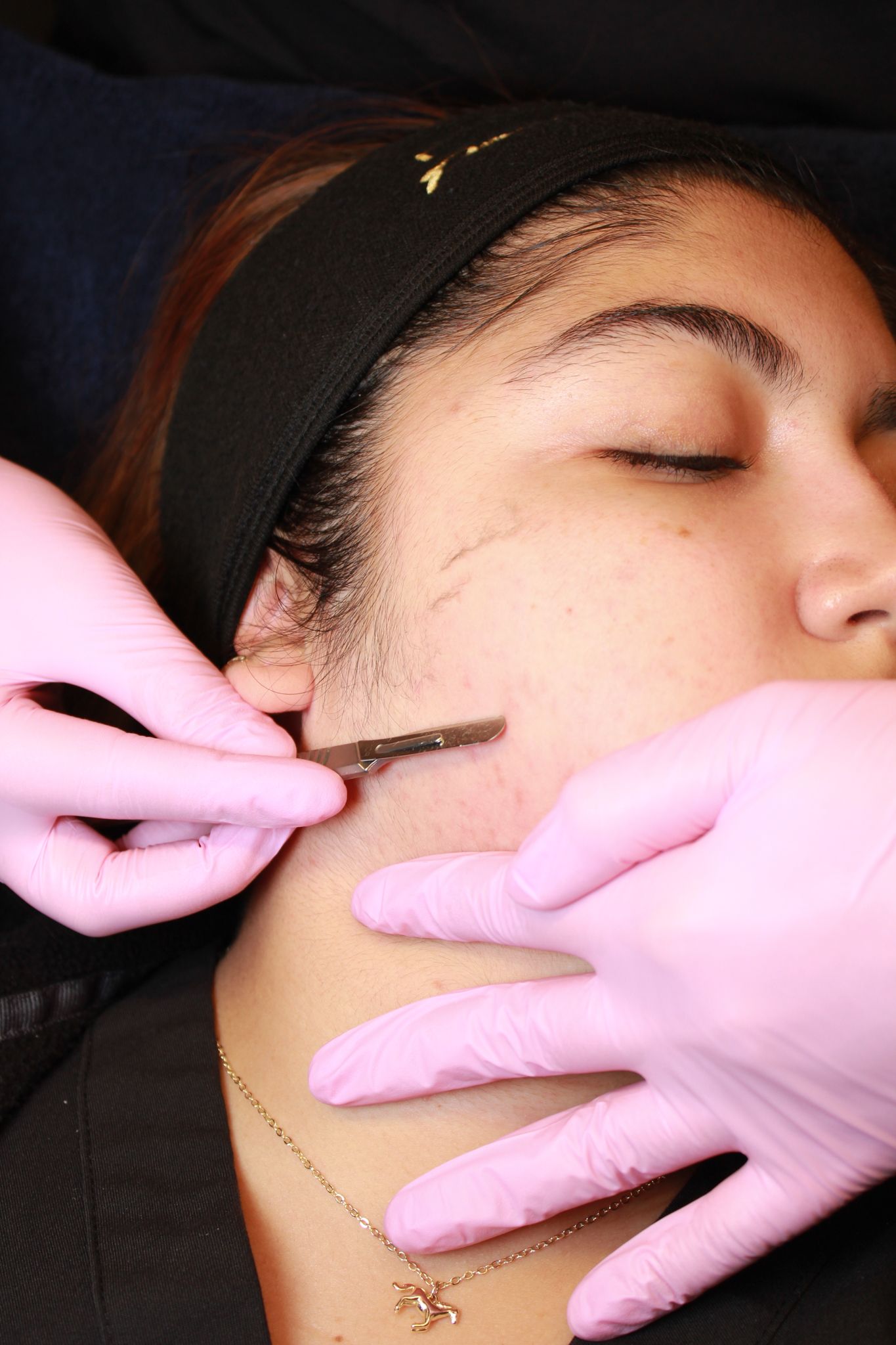 Esthetician in pink gloves performing dermaplaning facial treatment on a woman lying down with eyes closed.