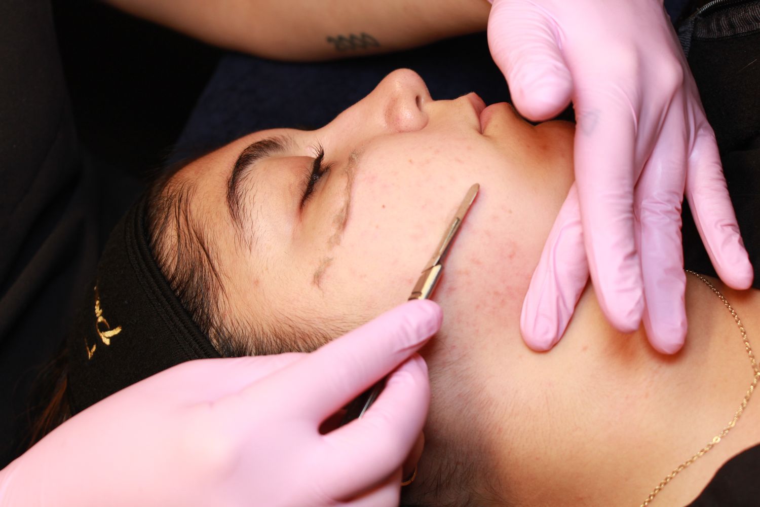 Esthetician in pink gloves performing a facial extraction treatment on a woman using a metal comedone extractor tool.